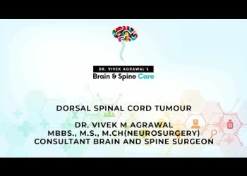 DORSAL SPINAL CORD TUMOUR